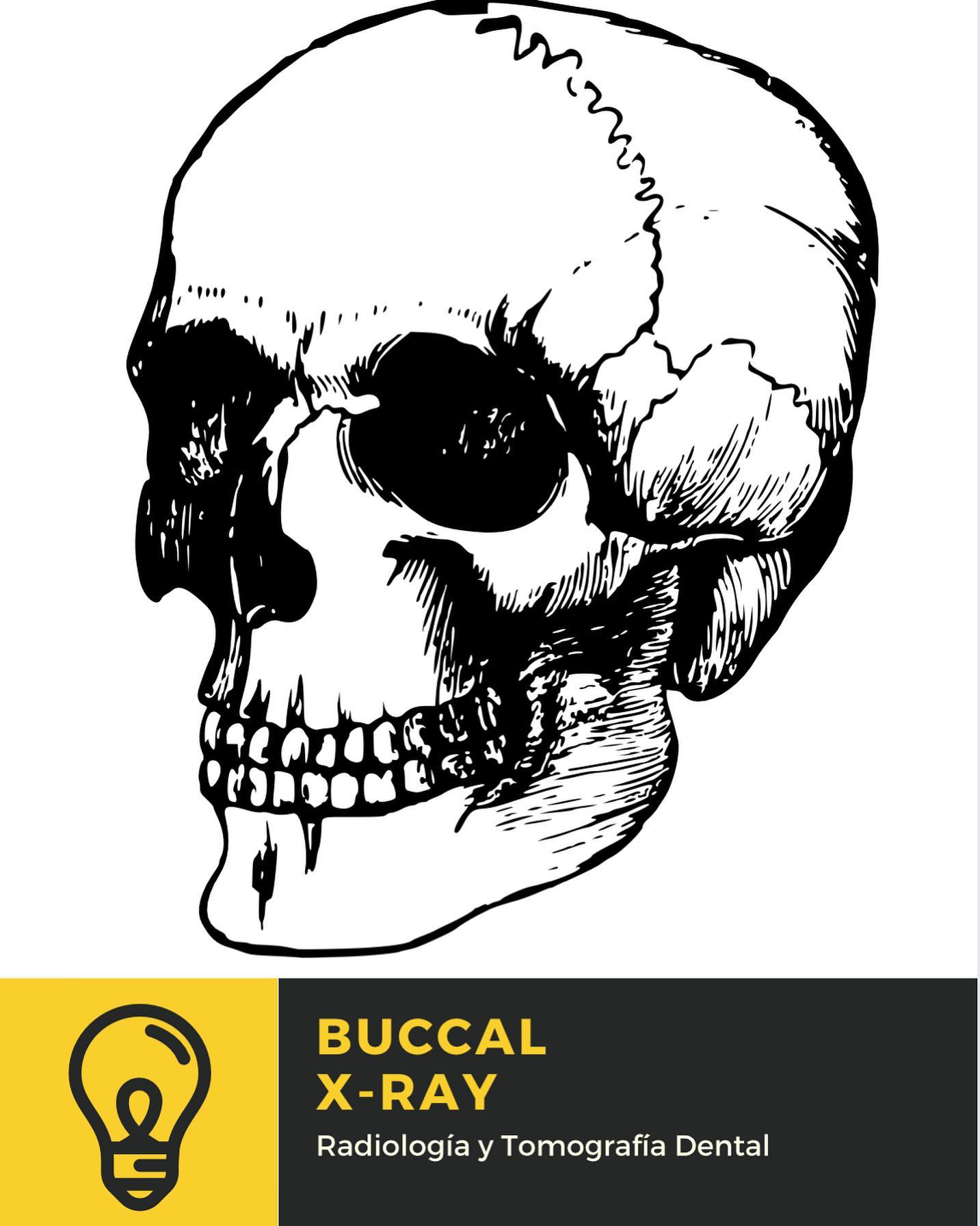 Buccal X-ray